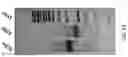 Fig. 11 - Methods For Targeted Complementary DNA Enrichment