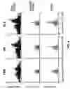Fig. 07 - Long non-coding RNA gene expression signatures in disease monitoring and treatment