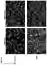 Fig. 03 - COMPOSITIONS AND METHODS FOR THE DIAGNOSIS AND TREATMENT OF LYMPHATIC SYSTEM DISORDERS