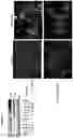 Fig. 13 - COMPOSITIONS AND METHODS FOR THE DIAGNOSIS AND TREATMENT OF LYMPHATIC SYSTEM DISORDERS
