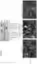 Fig. 18 - COMPOSITIONS AND METHODS FOR THE DIAGNOSIS AND TREATMENT OF LYMPHATIC SYSTEM DISORDERS