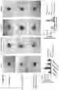 Fig. 21 - COMPOSITIONS AND METHODS FOR THE DIAGNOSIS AND TREATMENT OF LYMPHATIC SYSTEM DISORDERS