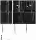 Fig. 23 - COMPOSITIONS AND METHODS FOR THE DIAGNOSIS AND TREATMENT OF LYMPHATIC SYSTEM DISORDERS