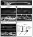 Fig. 29 - COMPOSITIONS AND METHODS FOR THE DIAGNOSIS AND TREATMENT OF LYMPHATIC SYSTEM DISORDERS