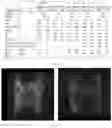 Fig. 30 - COMPOSITIONS AND METHODS FOR THE DIAGNOSIS AND TREATMENT OF LYMPHATIC SYSTEM DISORDERS