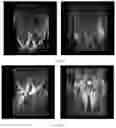 Fig. 31 - COMPOSITIONS AND METHODS FOR THE DIAGNOSIS AND TREATMENT OF LYMPHATIC SYSTEM DISORDERS