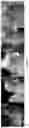 Fig. 03 - Targeting treatment for ADAM30 in pathological cells