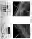 Fig. 16 - Targeting treatment for ADAM30 in pathological cells