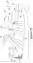 Fig. 17 - Article with at least two securable inlaid strands