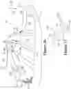 Fig. 18 - Article with at least two securable inlaid strands