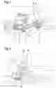 Fig. 02 - Method for operating a cleaning vehicle