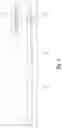 Fig. 10 - Cylindrical lever locking system