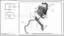 Fig. 01 - Systems and methods for hole detection in crankcase ventilation tubing