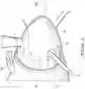 Fig. 03 - Aircraft propulsion system with propeller and cooling fan