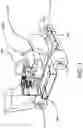 Fig. 04 - Shifter Cart Device