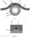 Fig. 04 - Subsea Flowline Blockage Remediation Using External Heating Device