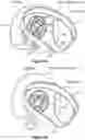 Fig. 45 - MOUNTING SYSTEMS FOR ELECTRONIC DEVICES