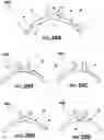 Fig. 30 - Adjustable heat transfer element