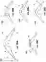 Fig. 31 - Adjustable heat transfer element