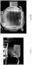 Fig. 04 - Silicon photomultiplier imaging system and method for cooling the same