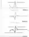 Fig. 02 - Method of intrinsic spectral analysis and applications thereof