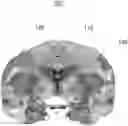 Fig. 01 - NEUROTRANSMITTER-BASED BRAIN MAPPING METHOD AND USE OF BRAIN MAP