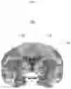 Fig. 02 - NEUROTRANSMITTER-BASED BRAIN MAPPING METHOD AND USE OF BRAIN MAP