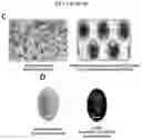 Fig. 04 - MICROFLUIDIC DEVICE AND METHOD OF PREPARING A CELL MODEL FOR DISEASE ASSOCIATED WITH CANCER