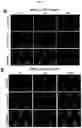 Fig. 12 - MICROFLUIDIC DEVICE AND METHOD OF PREPARING A CELL MODEL FOR DISEASE ASSOCIATED WITH CANCER