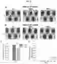 Fig. 17 - MICROFLUIDIC DEVICE AND METHOD OF PREPARING A CELL MODEL FOR DISEASE ASSOCIATED WITH CANCER
