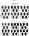 Fig. 18 - MICROFLUIDIC DEVICE AND METHOD OF PREPARING A CELL MODEL FOR DISEASE ASSOCIATED WITH CANCER