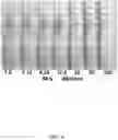Fig. 10 - RAPID DIAGNOSTIC TESTS UTILIZING TRAP REGIONS