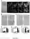 Fig. 05 - Methods of Detecting and Treating a Tumor Expressing PT346 PDK1