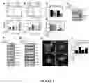 Fig. 07 - Methods of Detecting and Treating a Tumor Expressing PT346 PDK1