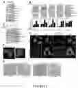 Fig. 13 - Methods of Detecting and Treating a Tumor Expressing PT346 PDK1