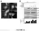 Fig. 15 - Methods of Detecting and Treating a Tumor Expressing PT346 PDK1