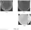 Fig. 17 - SYSTEMS AND METHODS FOR VESICLE CARGO LABELING AND DETECTION