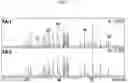 Fig. 04 - System and method of analysis of a protein using liquid chromatography-mass spectrometry