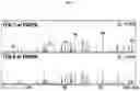 Fig. 06 - System and method of analysis of a protein using liquid chromatography-mass spectrometry