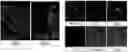 Fig. 01 - IN VITRO METHOD FOR THE DIAGNOSIS OR PROGNOSIS OF NEURODEGENERATIVE DISORDERS