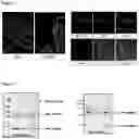 Fig. 02 - IN VITRO METHOD FOR THE DIAGNOSIS OR PROGNOSIS OF NEURODEGENERATIVE DISORDERS