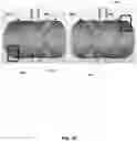 Fig. 13 - Resistive electromagnet systems and methods