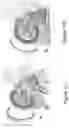 Fig. 14 - SYSTEMS AND METHODS FOR PERFORMING MAGNETIC RESONANCE IMAGING