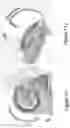 Fig. 17 - SYSTEMS AND METHODS FOR PERFORMING MAGNETIC RESONANCE IMAGING
