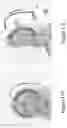 Fig. 18 - SYSTEMS AND METHODS FOR PERFORMING MAGNETIC RESONANCE IMAGING