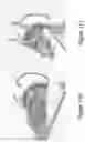 Fig. 22 - SYSTEMS AND METHODS FOR PERFORMING MAGNETIC RESONANCE IMAGING