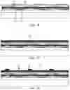 Fig. 09 - Display panel and preparation method thereof, and display apparatus