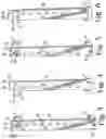Fig. 03 - FAIL-SAFE RELEASE MECHANISM FOR USE WITH PATIENT POSITIONING SUPPORT APPARATI