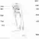 Fig. 01 - Speed regulating hand brake mechanism and method for speed regulation of same