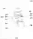 Fig. 03 - Speed regulating hand brake mechanism and method for speed regulation of same